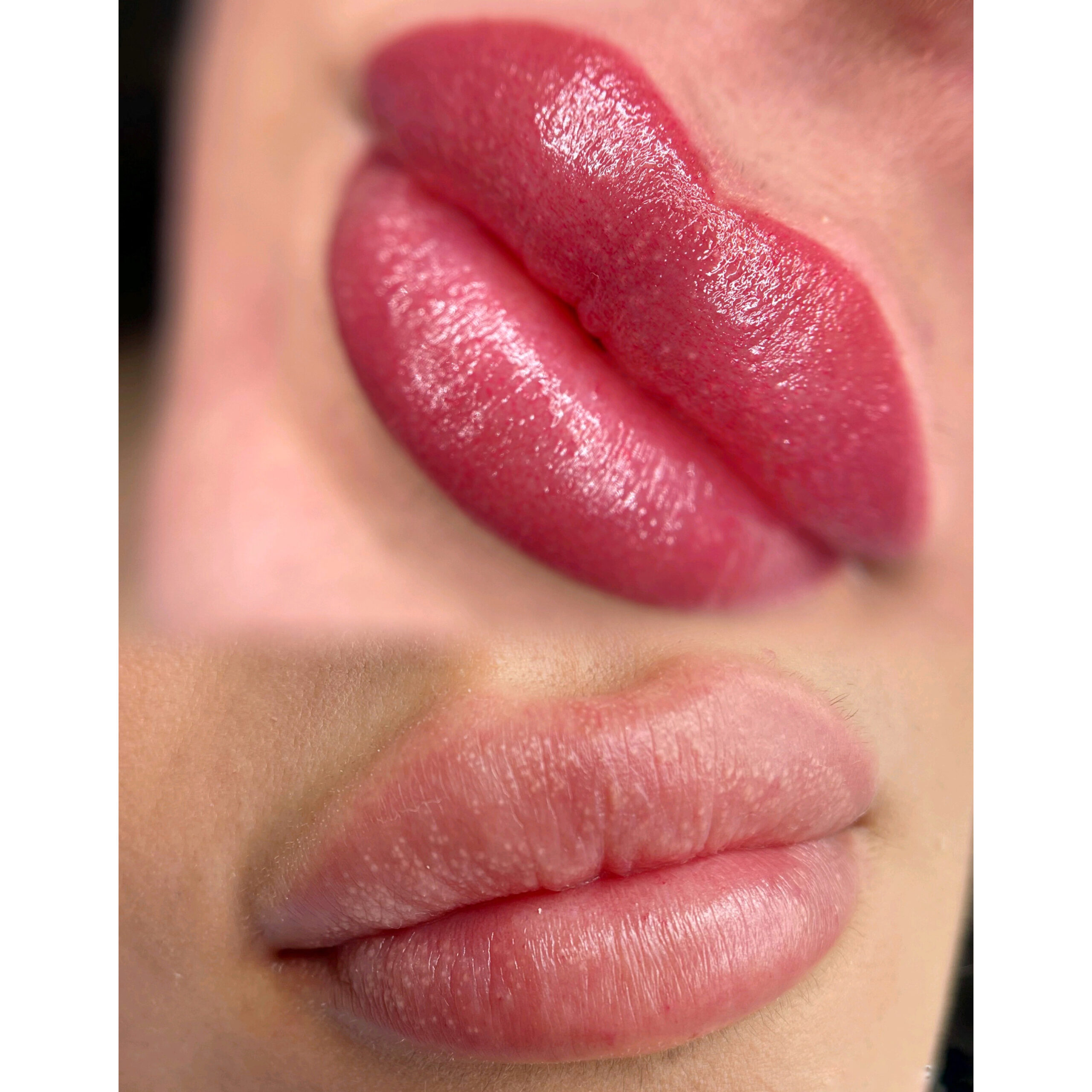 cameraRollTempImage 3